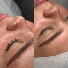 Antes y después Skin and soul (2)