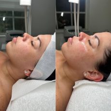 Antes y después Skin and soul (3)