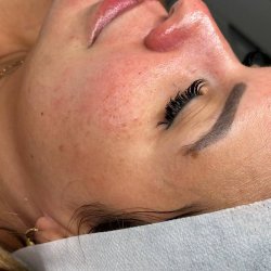 Skin and soul Pacientes (14)