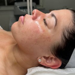 Skin and soul Pacientes (5)