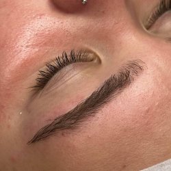 Skin and soul Pacientes (7)