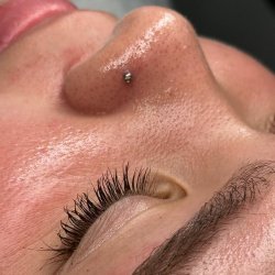 Skin and soul Pacientes (9)